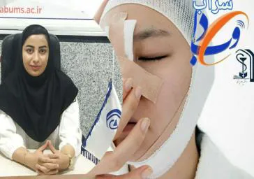 مواظب شکستگی بینی باشید
